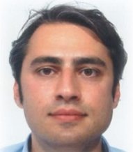 Alessandro Carrozzo, fellowship faculty at University of Rome La Sapienza-Sant'Andrea Hospital