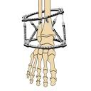 The Pediatric Orthopedic Center logo